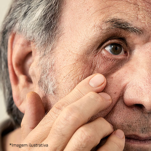 Unimed JF - Glaucoma: O que  e como prevenir?
